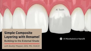 Colormatching with Dental Composite [upl. by Asoral]