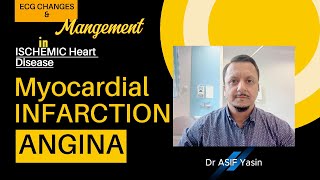 Ischemic heart disease  MI  NSTEMI  Angina  ECG  ‫ڈاکٹر آصف یاسین‬  mbbs NEB plab PMDC [upl. by Rosabel]