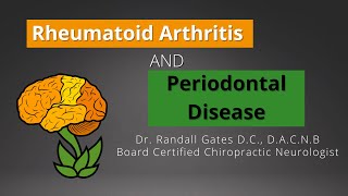 Rheumatoid Arthritis and Periodontal Disease [upl. by Hut781]