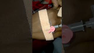 Intravenous cannula method  IV Cannulation technique porcedure amp Practical [upl. by Nonnarb]