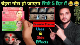 Gomela skin creamuses amp side effects full review in hindiGomela forte creamClin skin cream [upl. by Ennairb]