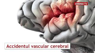 Accidentul vascular cerebral [upl. by Nayk]