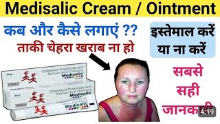 medisalic cream review in hindi l madisalic cream ke side effects medisalic cream for pigmentation [upl. by Aisekal]