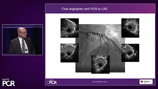 Left main bifurcations latest clinical data applied to practical cases  EuroPCR 2022 [upl. by Nodgnal36]