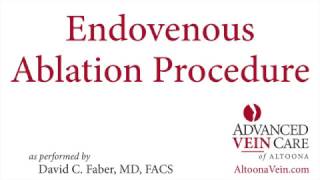 Endovenous Ablation Procedure [upl. by Eanore]