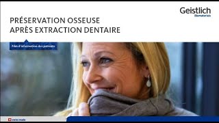 Extraction d’une dent – que faire maintenant [upl. by Mij]