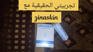 تجربتي الحقيقية مع المكمل الغذائي zinaskin كحل لمن تعاني من تساقط الشعر بدون لغة خشبة [upl. by Mahda]