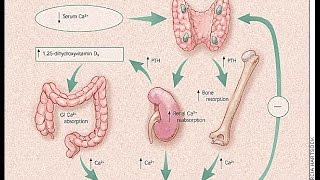 Hyperparathyroidism [upl. by Renelle190]