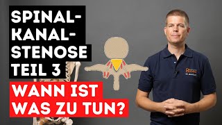 Spinalkanalstenose  Therapiereihenfolge  Was besonders wichtig ist  Teil 3 [upl. by Cesya]