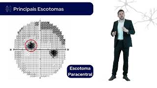 DECIFRANDO A SEMIOLOGIA NEUROLÓGICA  CURSO TEÓRICO [upl. by Aznofla]