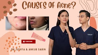 Cause of Acne  Root Causes of Acne  Acne के कारण  Dr Ankur amp Dr Jushya Bhatia [upl. by Eldora378]