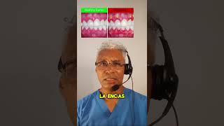 🦷 Que es la gingivitis o 💉 sangramiento de encías [upl. by Langley]