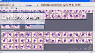 CellaVision DM Analyzers [upl. by Anairt]