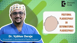 Flat Head Syndrome Plagiocephaly amp Its Treatment newborn  Dr Vybhav Deraje  Doctors Circle [upl. by Hutton]