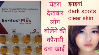 Medicines to boost Healthy Skin Nails Hair Joints amp Bones  HINDI  Hello Doctor Evotus Plus [upl. by Banks898]