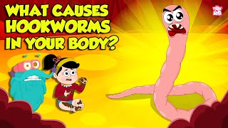 What causes Hookworm। Intestinal Worms Symptoms and Treatment  Worm Infection  Dr Binocs Show [upl. by Austen]