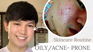 How To Skincare for Oily amp Acne Prone Skin  2022 Philippines [upl. by Ibor]