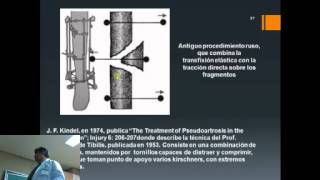 Historia de la Fijación Externa en Traumatología y Ortopedia [upl. by Butte101]