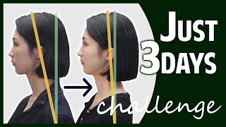 100 REAL｜Fix Forward Head Posture in 3DAYS｜Text Neck Fix Challenge [upl. by Whitaker]