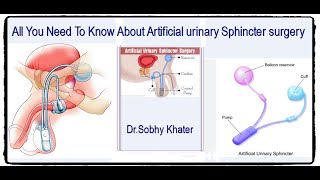 Artificial Urinary Sphincter Placement [upl. by Slaby623]