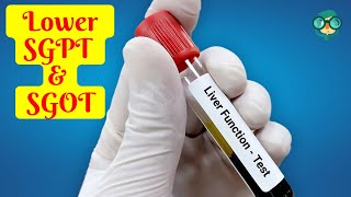 How to Lower SGPT and SGOT in 1 week How to Lower SGPT in 1 Week How to Lower SGOT in 1 Week [upl. by Salangia]