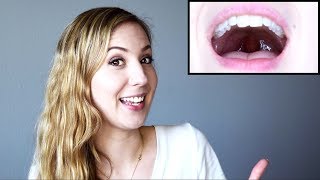 How to Raise Your Soft Palate and Open Your Voice [upl. by Hpeosj]