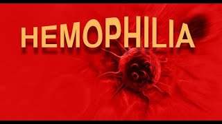 Understanding Hemophilia Causes Symptoms and Treatments [upl. by Groeg]