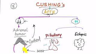 Cushing Syndrome Diagnostic Workup [upl. by Garihc409]