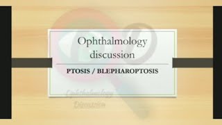 Ptosis  Blepharoptosis l Treatment of ptosis  Examination of ptosis [upl. by Leuams]