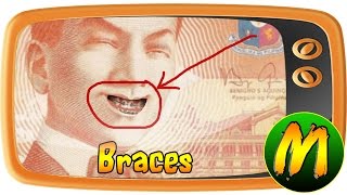 USAPANG PERA Braces [upl. by Eneluj]