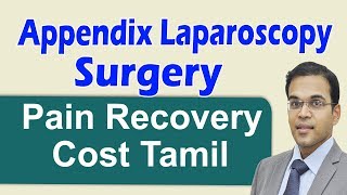 Appendix Laparoscopy Surgery Painfree Hospital Recovery Cost Best Laparoscopic Surgeon in Coimbator [upl. by Rufena]