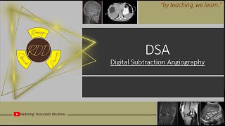 Digital Subtraction Angiography [upl. by Vicki]