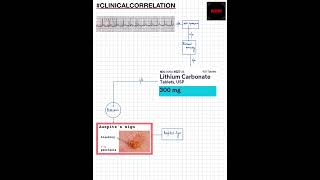 Shorts ClinicalCorrelation NEETNEXTPGFMGEMBBSWPW SYNDROME EBSTEIN ANOMALY LITHIUMPSORIASIS [upl. by Narol910]