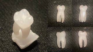 Wax Carving of Maxillary First Molar  Oral Anatomy HD [upl. by Audra]