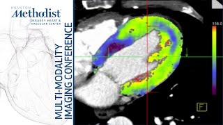 CTA for Assessment of Coronary Anatomy and Physiology SuMin Chang MD December 7 2021 [upl. by Leasi]