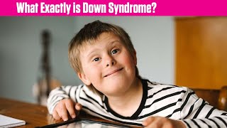 What Exactly is Down Syndrome [upl. by Tak]