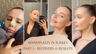 Rhinoplastynose job experience in Turkey vlog pt 2  surgery recovery amp results  Dr Orhan Ucal [upl. by Salisbarry]