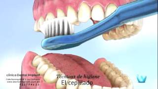 Tips para pacientes Técnicas de Cepillado [upl. by Behrens792]