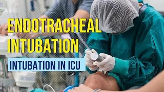 Endotracheal intubation Step by step procedure [upl. by Woermer]