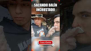 😱SACANDO BALÍN INCRUSTADO😱 ▬ CORRECTO PROCEDIMIENTO ▬ airsoft gameplay shorts [upl. by Huldah]