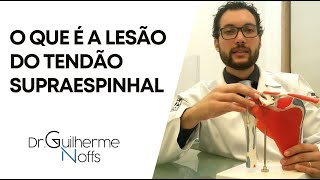 Lesão do Tendão Supraespinhal  Dr Guilherme Noffs [upl. by Frodi]