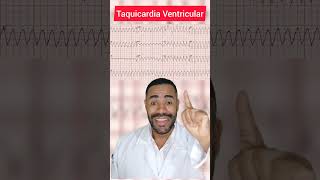 Taquicardia Ventricular ecg [upl. by Yelsna]