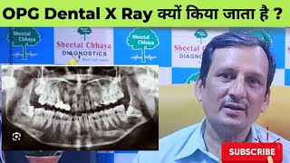 OPG क्यों कराई जाती है  what is OPG Digital Dental X Ray dentaltreatments dentalxray ajaykaushik [upl. by Caplan181]