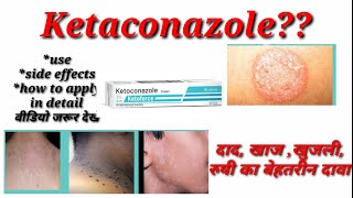 Nizral 2  Ketoconazole Solution  How to use  personal Reviews [upl. by Belldame]