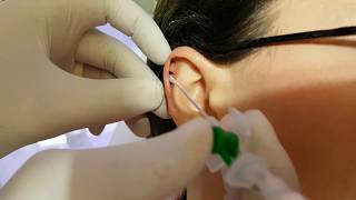 Kıkırdak Helix Piercing Delimi Acı Oranı [upl. by Haral]