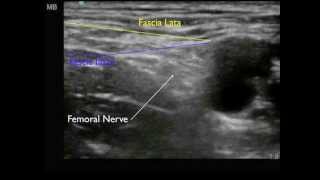 Femoral Nerve anatomy [upl. by Syla]