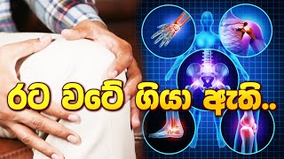 රට වටේ ගියා ඇති ayurveda sinhalaayurveda arthritis arthritismedication [upl. by Aitselec]