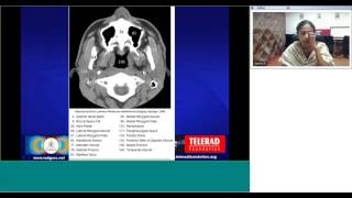 Maxillofacial CT anatomy by Dr Geetha Balasubramaniam [upl. by Stav764]