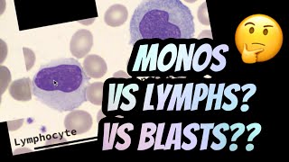 How I distinguish between Lymphocytes vs Monocytes [upl. by Narhet]