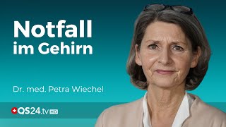 Gefahr im Gehirn Alles was Sie über den Schlaganfall wissen müssen  Visite  QS24 [upl. by Sukin]